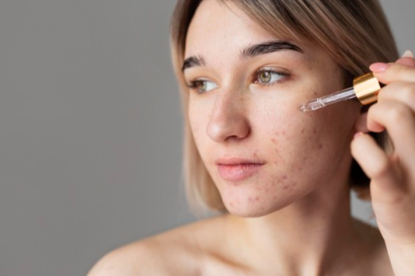 Kelebihan & Cara Mengatasi Kulit Kusam dengan Serum Scarlett